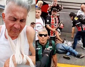 Habló el jubilado al que la Policía de Bullrich le quebró un brazo en la represión en Congreso