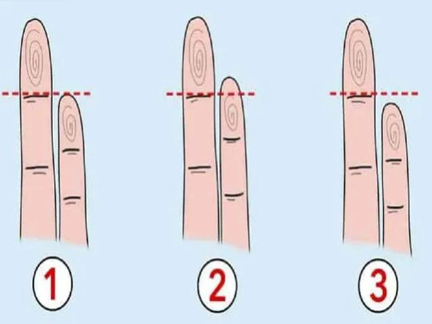 Test viral: el tamaño y la forma de tu dedo meñique revela cómo sos en el amor