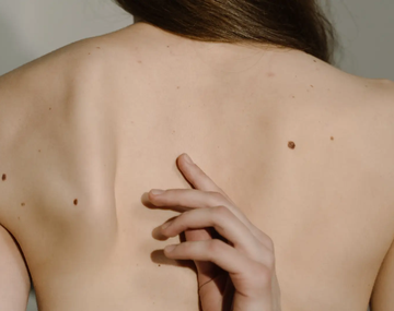 El test viral de los lunares en el cuerpo que revela cómo te ven los demás