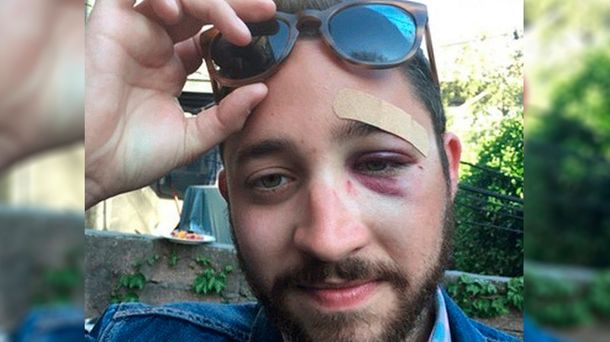 Recibió una paliza por parecerse a un famoso actor de Hollywood