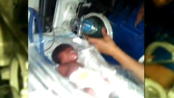 milagro en el apagon: mira el video de los medicos trabajando sin luz milagro en el apagon: mira el video de los medicos trabajando sin luz