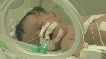 sacan a un bebe prematuro del vientre de su madre asesinada en gaza por un ataque israeli sacan a un bebe prematuro del vientre de su madre asesinada en gaza por un ataque israeli