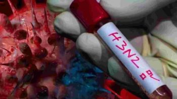 Súper gripe H3N2: qué es, cuáles son los síntomas y cómo se trata, según un médico especializado Súper gripe H3N2: qué es, cuáles son los síntomas y cómo se trata, según un médico especializado