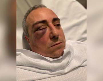 Brutal ataque piraña en Retiro: ocho delincuentes golpearon y robaron a un hombre