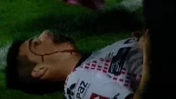 con lo que cuesta hacer goles: dos jugadores se lastimaron en el festejo con lo que cuesta hacer goles: dos jugadores se lastimaron en el festejo