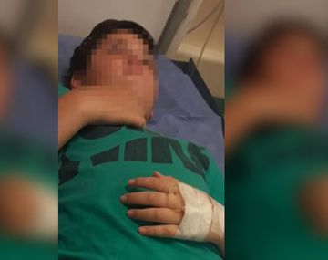 Un nene de 11 años sufrió una brutal golpiza en una escuela y fue internado