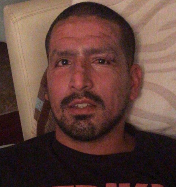 Viatri podría perder parte de la visión en un ojo por su accidente con pirotecnia