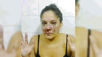 brutal golpiza de una patota a una joven por cheta