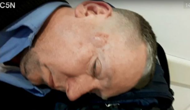 Otro ataque a un colectivero: lo golpearon con una manopla y estuvo una hora inconsciente