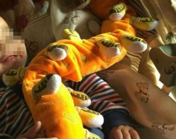 Valentino, el bebe de ocho meses internado