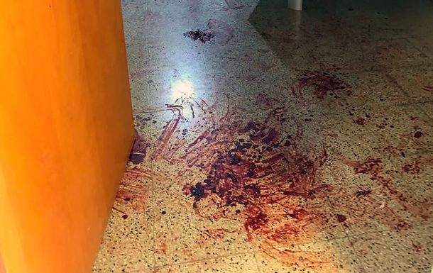 Sigue el misterio en la Universidad de Córdoba por la sangre hallada en los baños