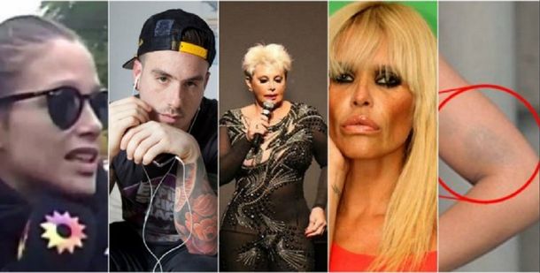 Moretón, polémica y denuncias: las claves del escándalo entre Fede y Barbie