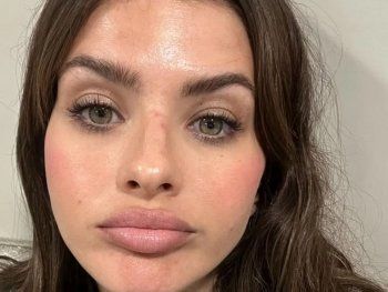 El accidente que sufrió la China Suárez: Me rompí la nariz