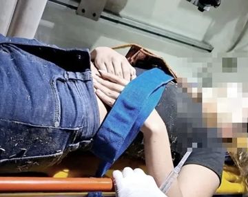 Violento episodio en Morón: una menor con autismo sufrió feroz agresión en un corso