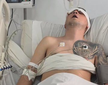 Tucumán: brutal agresión a un joven en un boliche