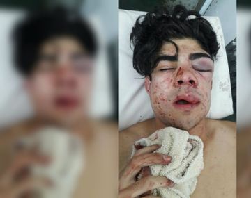 El adolescente de 18 años terminó internado