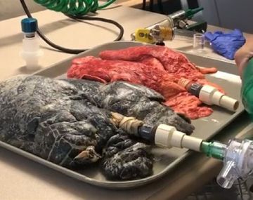 ¡Alerta fumadores! Así respiran tus pulmones que sufren el efecto del tabaco