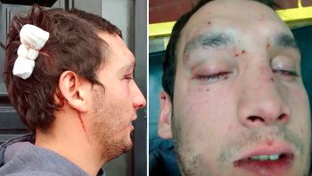 fue a bailar a un boliche de quilmes y un patovica lo desfiguro a trompadas fue a bailar a un boliche de quilmes y un patovica lo desfiguro a trompadas