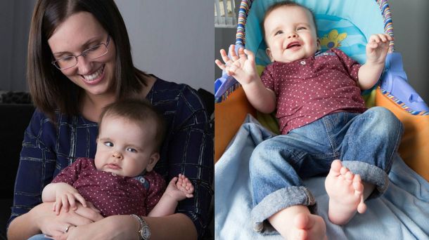 El increíble caso del niño que nació con 24 dedos entre manos y pies