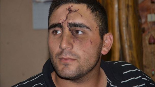 Brutal agresión: le desfiguraron la cara por hacerse policía