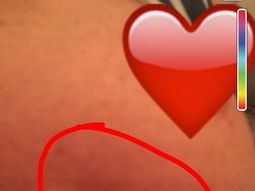 miren sus lolas: la foto de una enferma de cancer que podria salvar vidas miren sus lolas: la foto de una enferma de cancer que podria salvar vidas