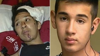 indignante: al bomberito heroe le robaron el celular y le tajearon la mano indignante: al bomberito heroe le robaron el celular y le tajearon la mano