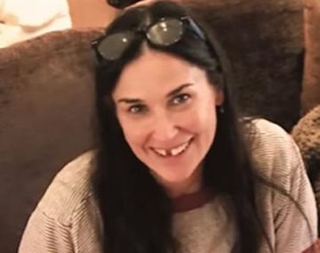 Demi Moore contó que se le cayeron dos dientes