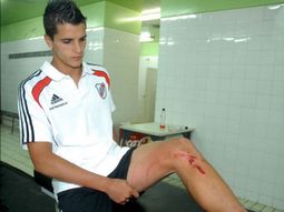 Lamela herida Lamela herida