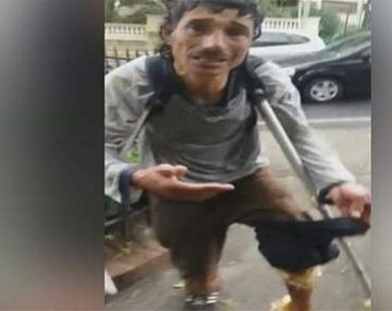 Un falso mendigo engañaba con una herida maquillada y ganaba una fortuna