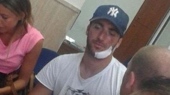 asi quedo gonzalo higuain tras un insolito accidente asi quedo gonzalo higuain tras un insolito accidente