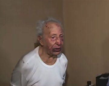Brutal asalto a un hombre de 88 años: le robaron 400 mil pesos y 7 mil dólares