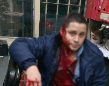 Paro de colectivos en el AMBA por la brutal agresión a un chofer