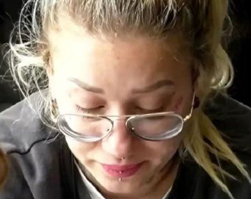 La Tana de Gran Hermano tuvo un fuerte accidente en moto: cómo está