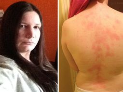 una extrana enfermedad la hace alergica una extrana enfermedad la hace alergica