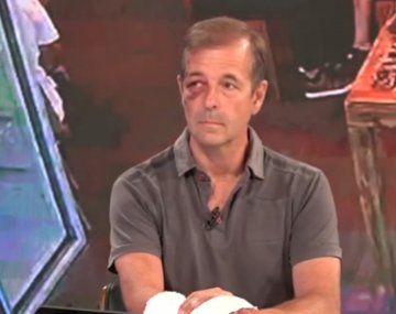 Un periodista víctima de un robo debió ser operado de urgencia