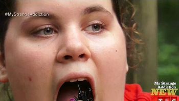 una adolescente se hizo adicta a comer gomas de autos una adolescente se hizo adicta a comer gomas de autos