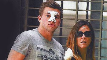 ¿que le paso en la nariz a leandro penna? ¿que le paso en la nariz a leandro penna?