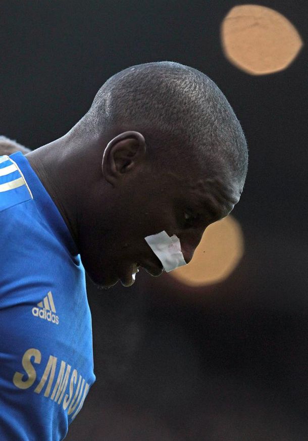 Coloccini le rompió la nariz a un ex compañero de una patada