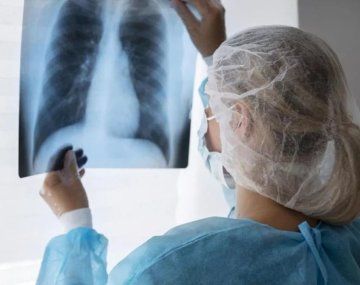 Alerta por aumento de casos de tuberculosis en Argentina: subieron un 80% en 5 años