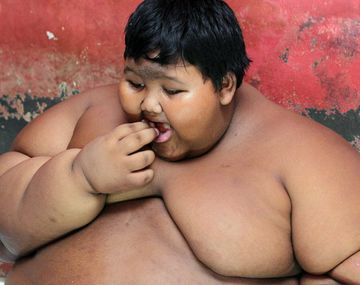 Temen por la vida del niño más obeso del mundo: pesa 192 kilos a los 10 años