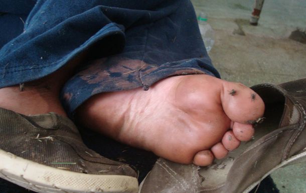 Montero: Hubo pacientes comidos por los perros