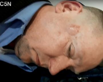 Otro ataque a un colectivero: lo golpearon con una manopla y estuvo una hora inconsciente