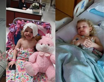 Una nena sufrió una reacción alérgica por el maquillaje