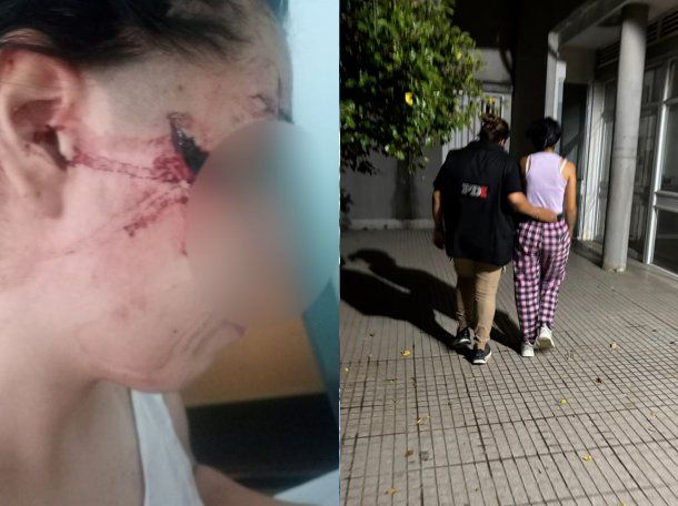 Horror en Santa Fe: atacaron a cuchillazos a una adolescente de 15 años y le desfiguraron la cara