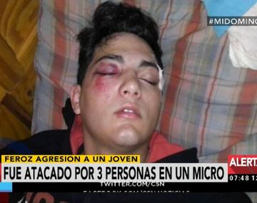 Feroz agresión en un colectivo: lo golpearon con un palo para robarle