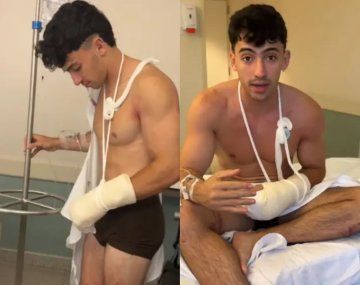 Gero Arias habló tras su accidente y se defendió de las críticas: Casi no la cuento