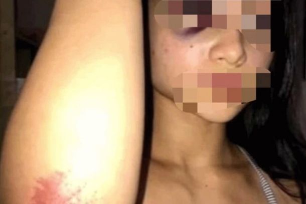 La victima tiene 18 años y vive en el interior de Formosa. Foto: Diario El Comercial.