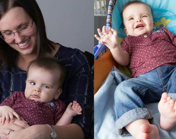 Un nene con 24 dedos entre manos y pies