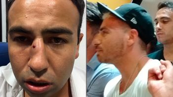 Fede Bal denunciado Fede Bal denunciado