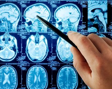 ¿Cómo es la ameba come cerebros que ya mató a un nene de 8 años en Argentina?